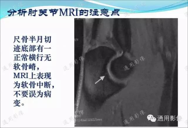【PPT】骨关节序列临床应用