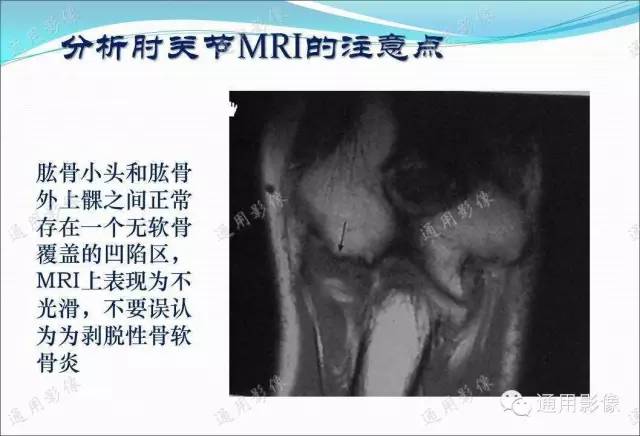 【PPT】骨关节序列临床应用