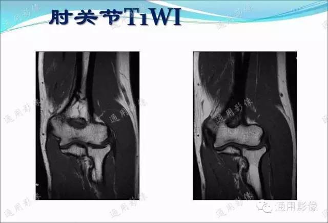 【PPT】骨关节序列临床应用