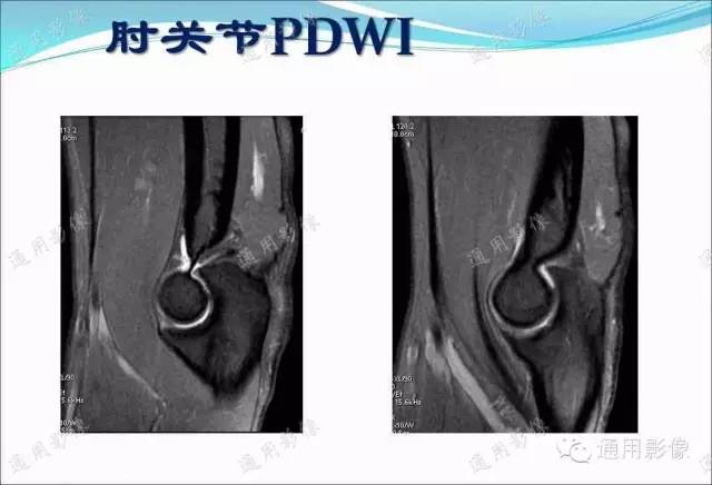 【PPT】骨关节序列临床应用