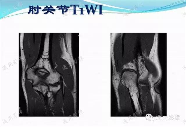 【PPT】骨关节序列临床应用