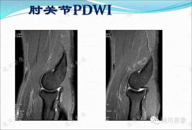 【PPT】骨关节序列临床应用