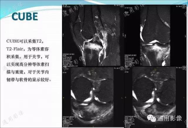 【PPT】骨关节序列临床应用