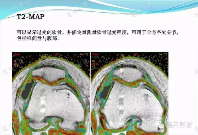 【PPT】骨关节序列临床应用
