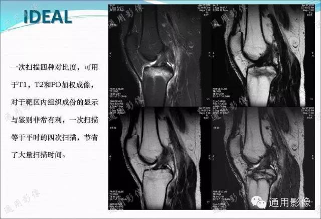 【PPT】骨关节序列临床应用