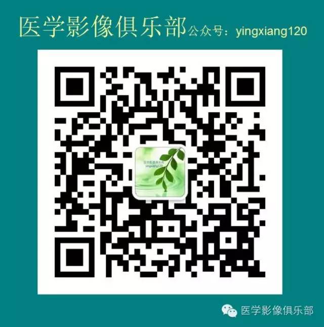 腮腺腺淋巴瘤的影像诊断 腮腺腺淋巴瘤的影像诊断