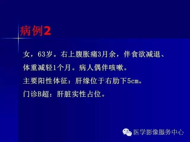 【病例】肝内胆管细胞癌1例CT影像表现与鉴别