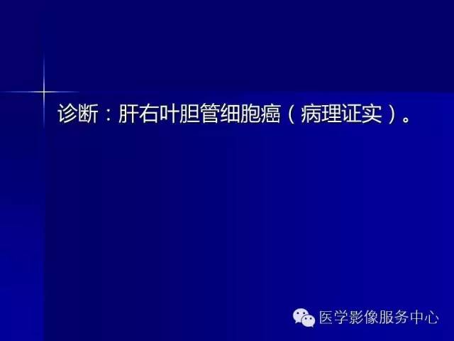 【病例】肝内胆管细胞癌1例CT影像表现与鉴别