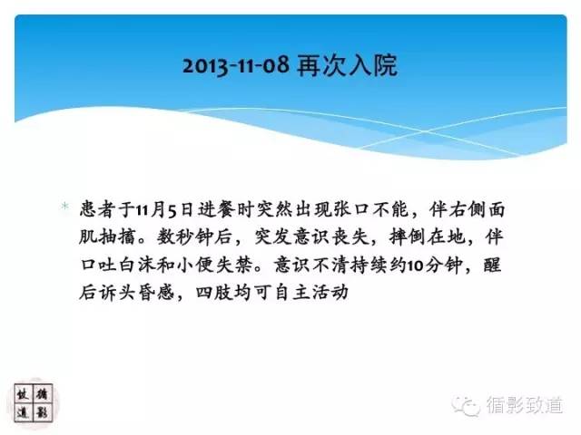 【病例】心房粘液瘤栓塞1例CNS影像表现