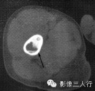 自动草稿