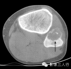 自动草稿 自动草稿