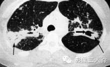 自动草稿