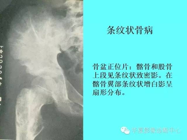 【PPT】骨发育障碍的影像学诊断