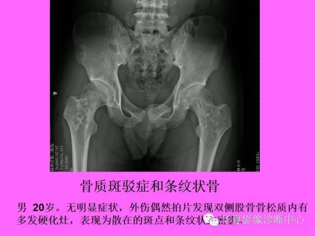 【PPT】骨发育障碍的影像学诊断