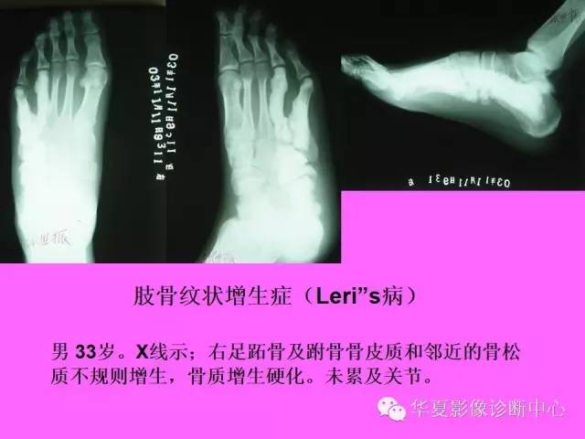 【PPT】骨发育障碍的影像学诊断