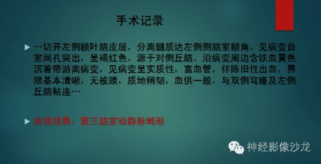 【病例】第三脑室动静脉畸形1例MR影像表现