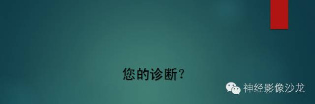 【病例】第三脑室动静脉畸形1例MR影像表现