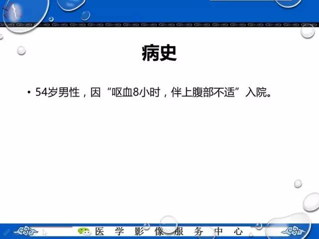【病例】胃间质瘤1例CT影像表现