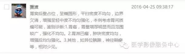 【病例】胃间质瘤1例CT影像表现 【病例】胃间质瘤1例CT影像表现