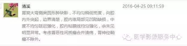 【病例】胃间质瘤1例CT影像表现 【病例】胃间质瘤1例CT影像表现