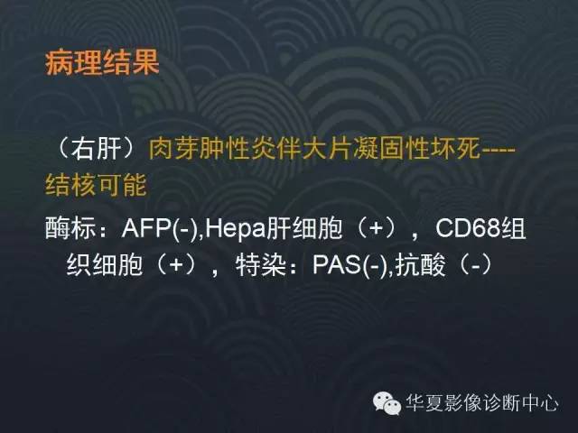 【病例】肝孤立性坏死结节1例MR影像表现