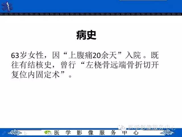 【病例】胃淋巴瘤1例CT影像表现