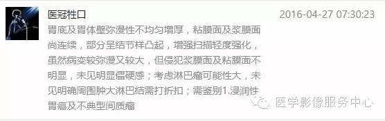 【病例】胃淋巴瘤1例CT影像表现