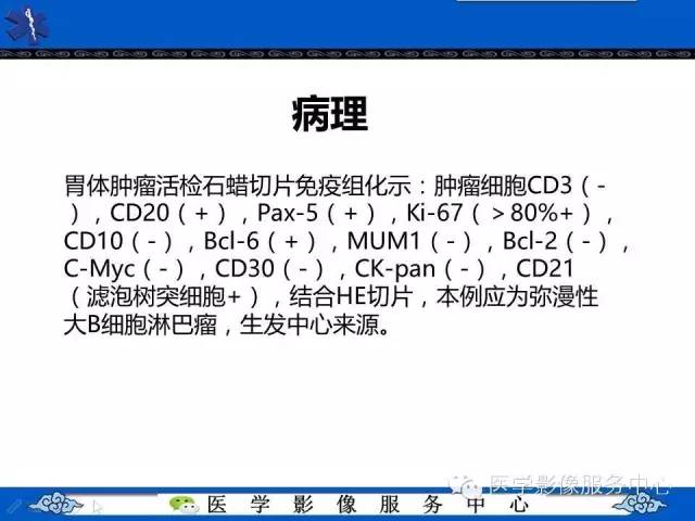 【病例】胃淋巴瘤1例CT影像表现