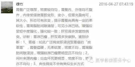 【病例】胃淋巴瘤1例CT影像表现