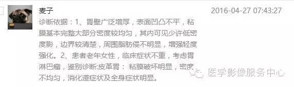 【病例】胃淋巴瘤1例CT影像表现