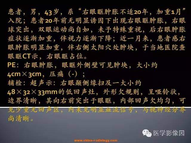 【病例】眼眶表皮样囊肿1例CT及MR影像表现