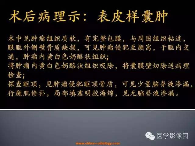 【病例】眼眶表皮样囊肿1例CT及MR影像表现