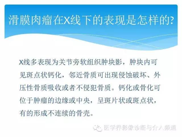 【PPT】滑膜肉瘤的影像诊断
