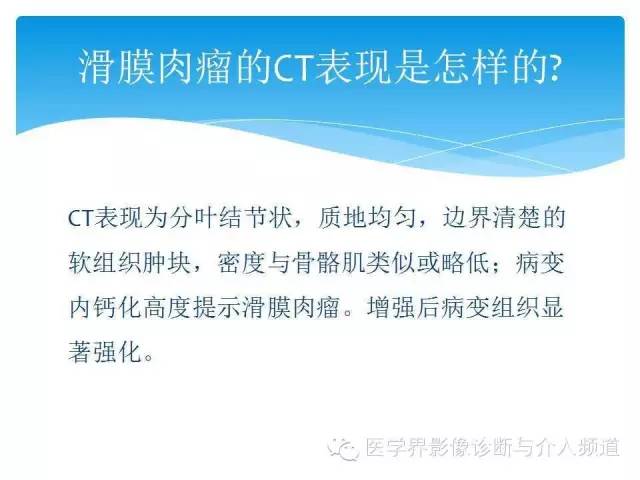 【PPT】滑膜肉瘤的影像诊断