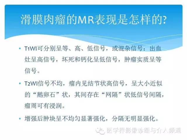 【PPT】滑膜肉瘤的影像诊断