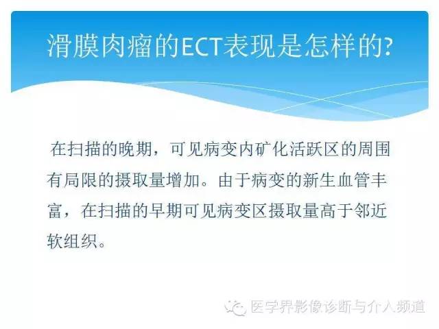 【PPT】滑膜肉瘤的影像诊断
