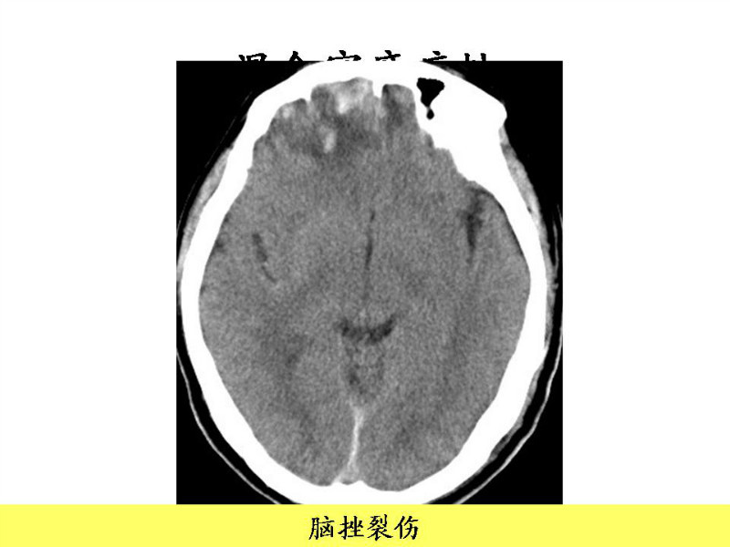 常见影像病例读片汇总