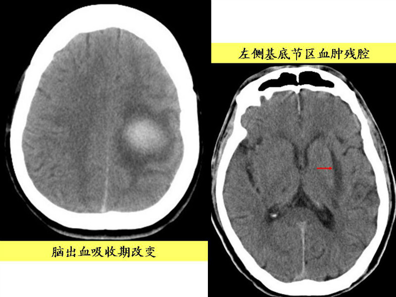 常见影像病例读片汇总