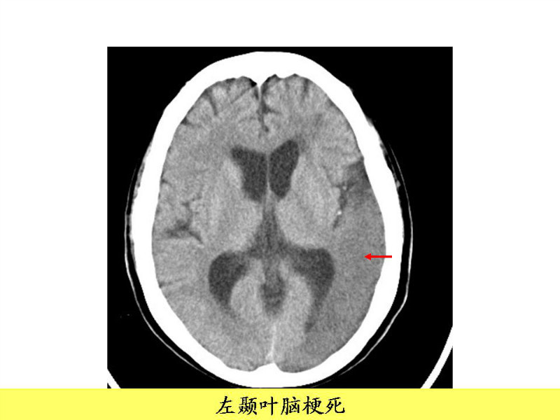 常见影像病例读片汇总