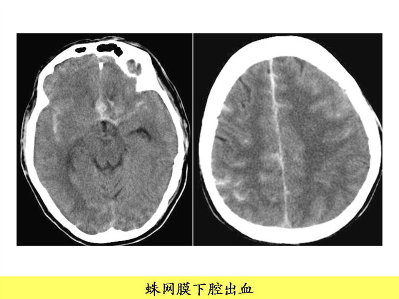 常见影像病例读片汇总