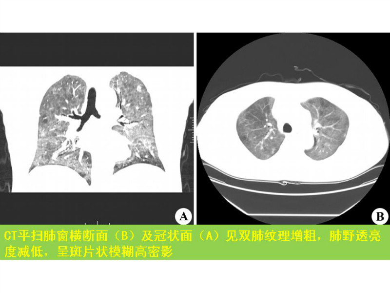 常见影像病例读片汇总