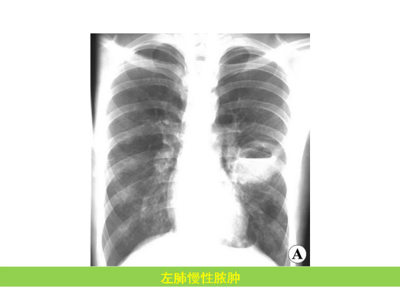 常见影像病例读片汇总