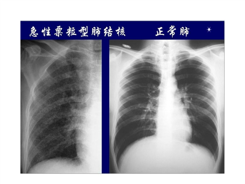 常见影像病例读片汇总