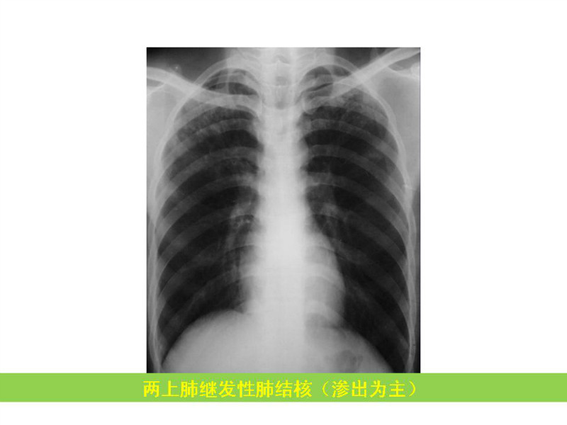 常见影像病例读片汇总