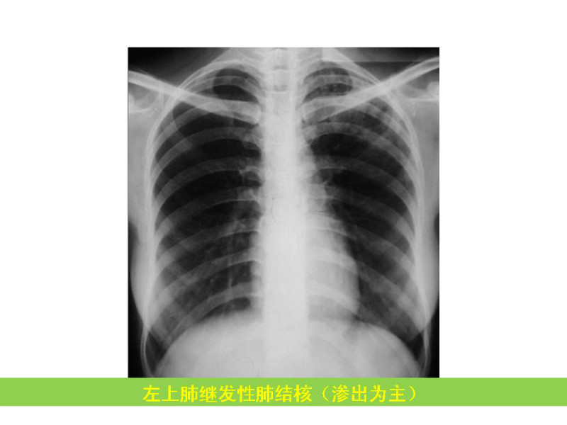 常见影像病例读片汇总