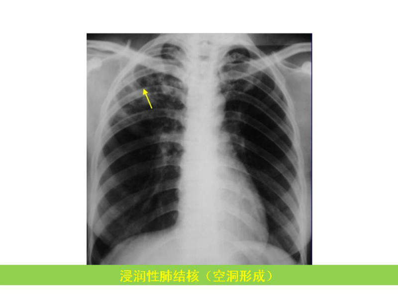 常见影像病例读片汇总
