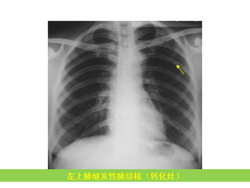 常见影像病例读片汇总