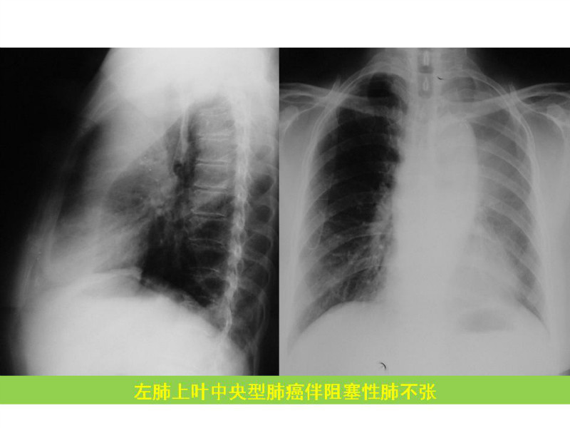 常见影像病例读片汇总