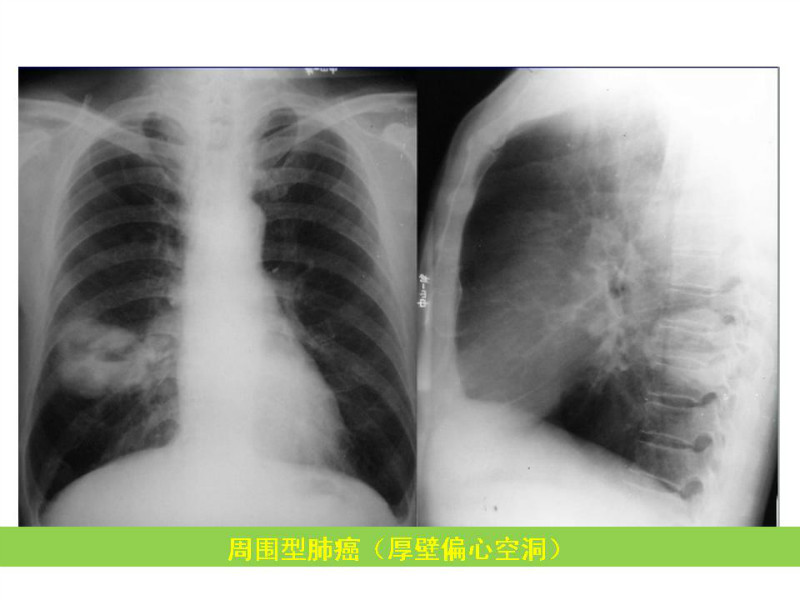 常见影像病例读片汇总