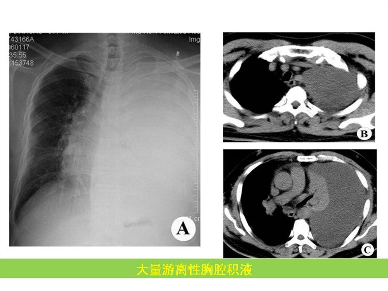 常见影像病例读片汇总